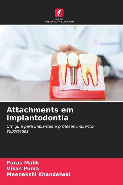 Produktbild: Attachments em implantodontia
