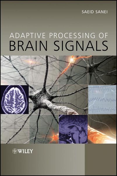 Produktbild: Adaptive Processing of Brain Signals