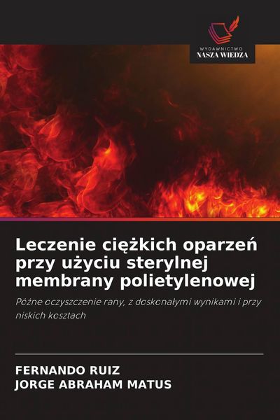 Produktbild: Leczenie ci&iquest;&iquest;kich oparze&iquest; przy u&iquest;yciu sterylnej membrany polietylenowej