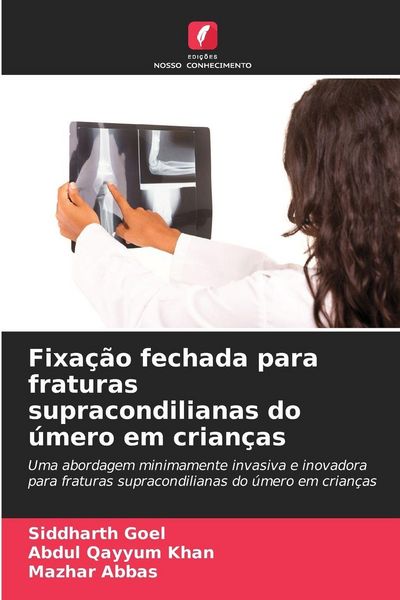 Produktbild: Fixa&ccedil;&atilde;o fechada para fraturas supracondilianas do &uacute;mero em crian&ccedil;as