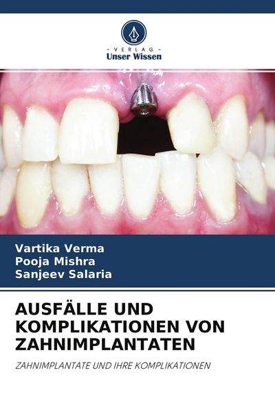 Ausfälle und Komplikationen von Zahnimplantaten, Taschenbuch von Vartika Verma , Pooja Mishra , Sanjeev Salaria, Verlag Unser Wissen, 9786203732283