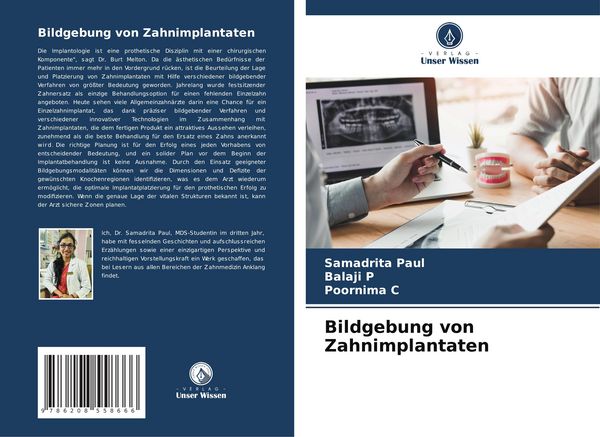 Produktbild: Bildgebung von Zahnimplantaten