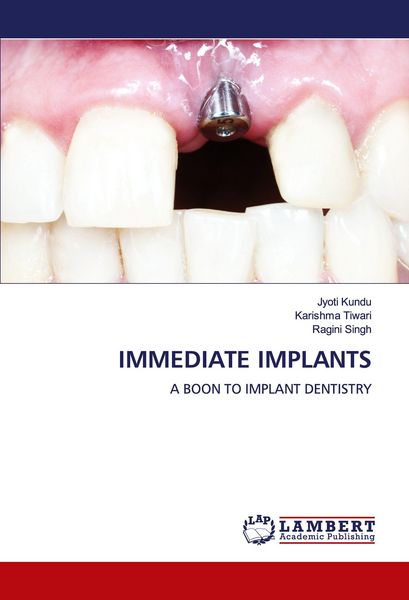 Produktbild: Immediate Implants