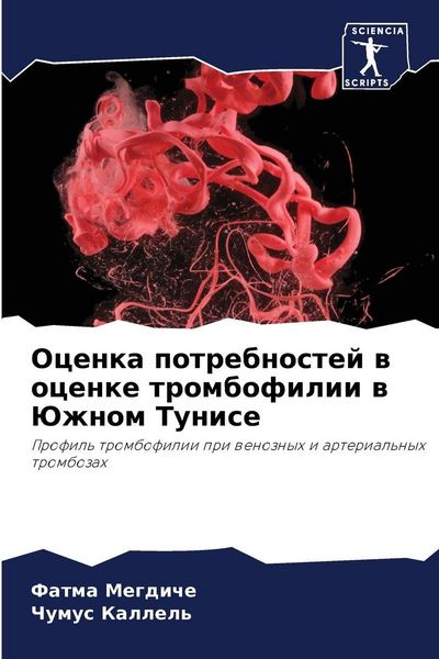 Produktbild: Ocenka potrebnostej w ocenke trombofilii w Juzhnom Tunise