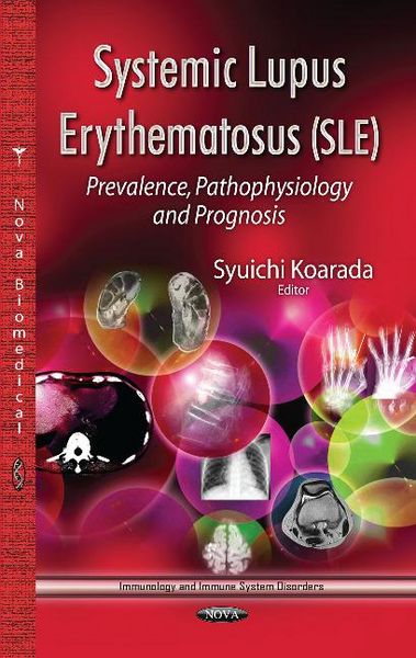 Produktbild: Systemic Lupus Erythematosus (SLE)