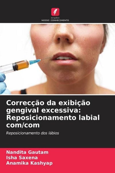 Produktbild: Correc&ccedil;&atilde;o da exibi&ccedil;&atilde;o gengival excessiva: Reposicionamento labial com/com