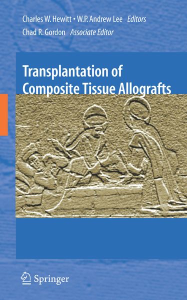 Produktbild: Transplantation of Composite Tissue Allografts
