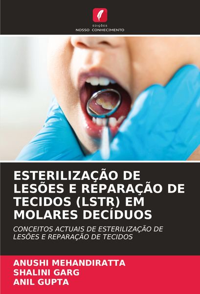 Produktbild: Esteriliza&ccedil;&atilde;o De Les&otilde;es E Repara&ccedil;&atilde;o De Tecidos (lstr) Em Molares Dec&iacute;duos