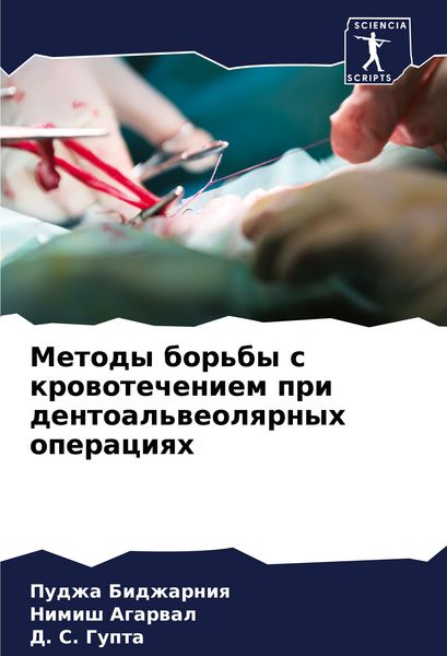 Produktbild: Metody bor'by s krowotecheniem pri dentoal'weolqrnyh operaciqh