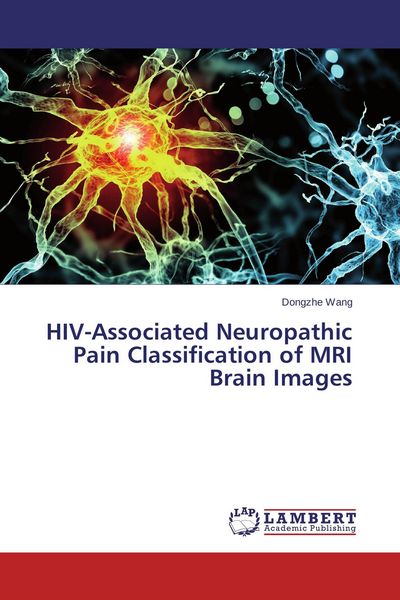 Produktbild: HIV-Associated Neuropathic Pain Classification of MRI Brain Images