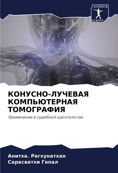 Produktbild: Konusno-Luchevaya Komp'juternaya Tomografiya