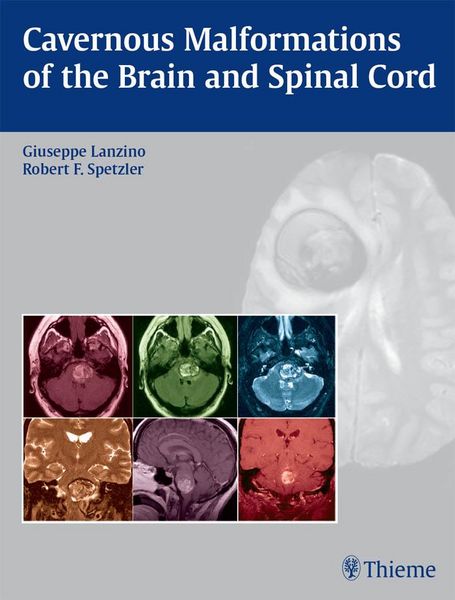 Produktbild: Cavernous Malformations of the Brain and Spinal Cord