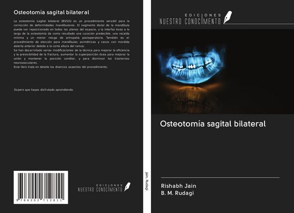 Produktbild: Osteotom&iacute;a sagital bilateral