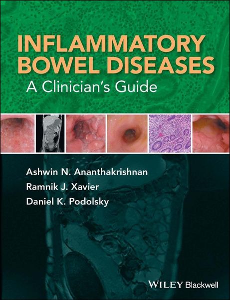 Produktbild: Inflammatory Bowel Diseases