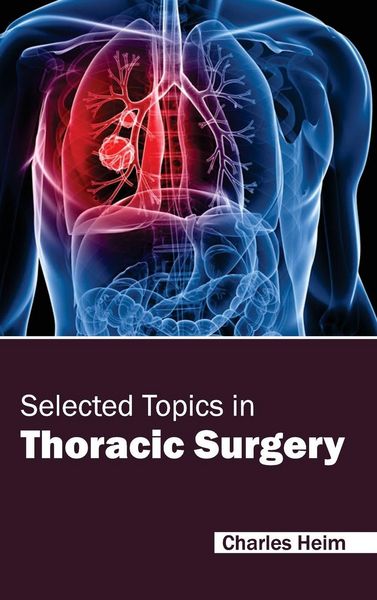 Produktbild: Selected Topics in Thoracic Surgery