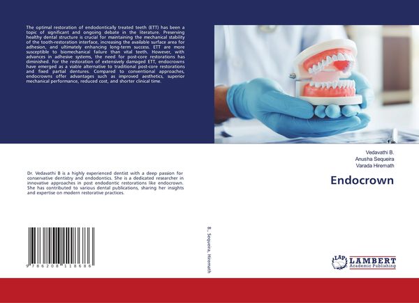 Produktbild: Endocrown