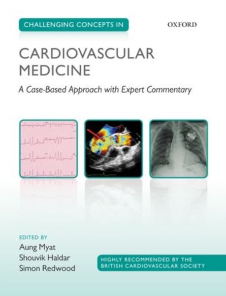 Produktbild: Challenging Concepts in Cardiovascular Medicine