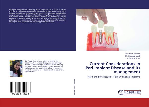 Produktbild: Current Considerations in Peri-implant Disease and its management