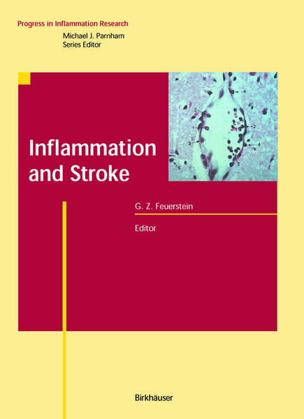 Produktbild: Inflammation and Stroke