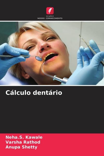 Produktbild: C&aacute;lculo dent&aacute;rio