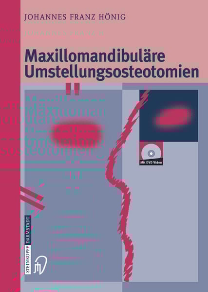 Maxillomandibuläre Umstellungsosteotomien, Taschenbuch von Johannes-Franz Hönig, Steinkopff, 9783642632846