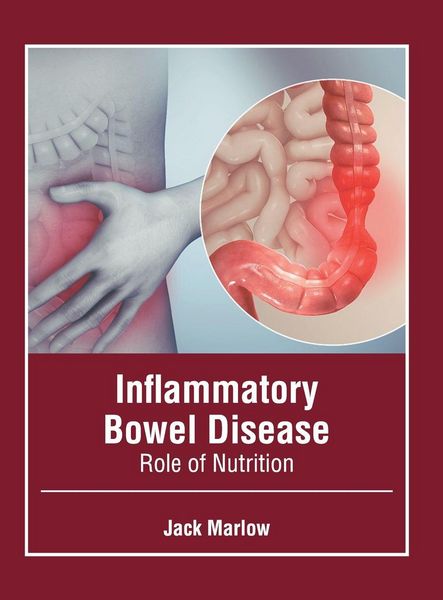 Produktbild: Inflammatory Bowel Disease: Role of Nutrition