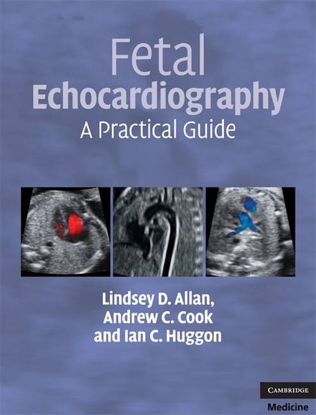 Produktbild: Fetal Echocardiography