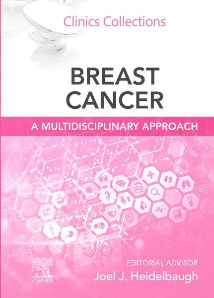 Produktbild: Breast Cancer: A Multidisciplinary Approach