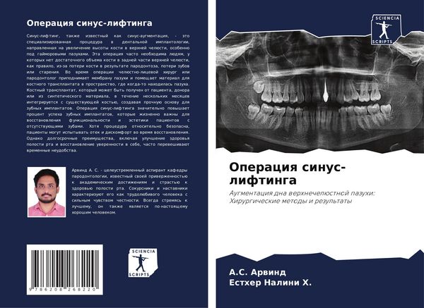 Produktbild: Operaciq sinus-liftinga