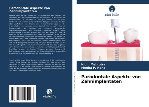 Parodontale Aspekte von Zahnimplantaten, Taschenbuch von Nidhi Mehrotra , Megha P. Rana, Verlag Unser Wissen, 9786207544127