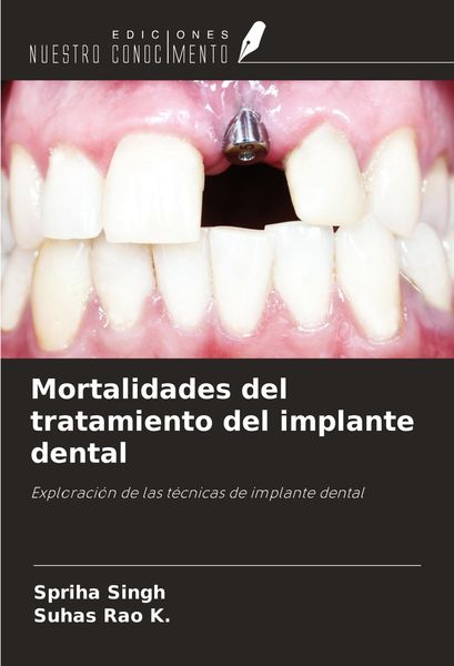 Produktbild: Mortalidades del tratamiento del implante dental