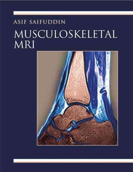 Produktbild: Saifuddin, A: Musculoskeletal MRI