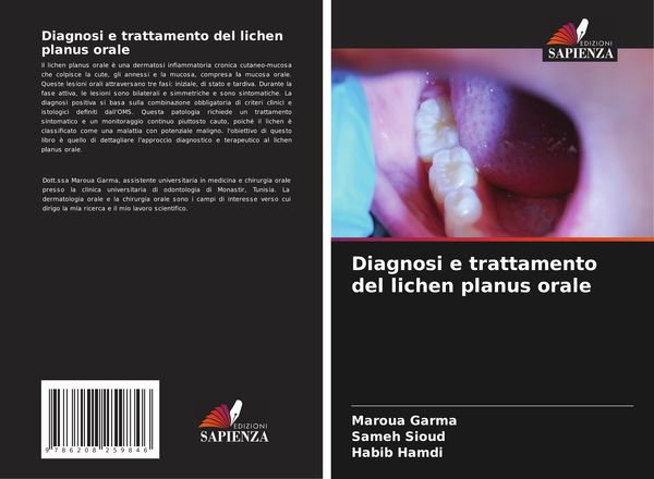 Produktbild: Diagnosi e trattamento del lichen planus orale