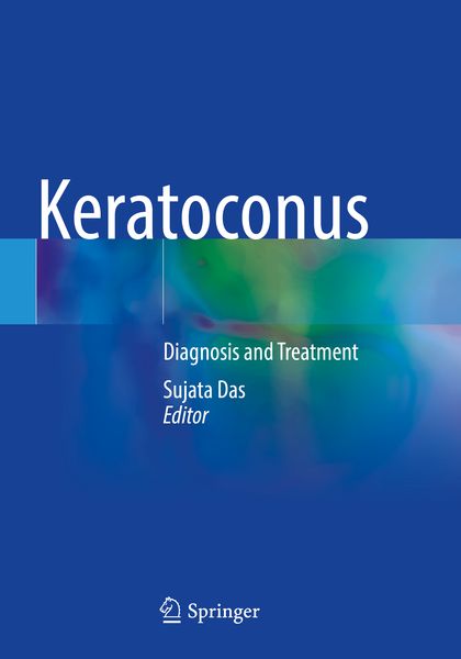 Produktbild: Keratoconus