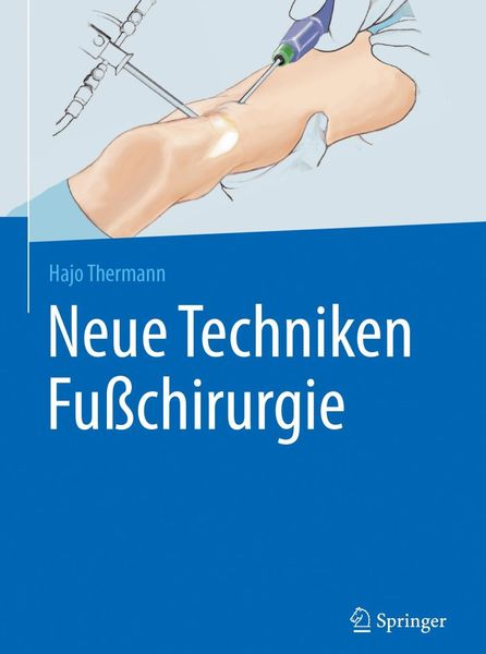 Produktbild: Neue Techniken Fu&szlig;chirurgie