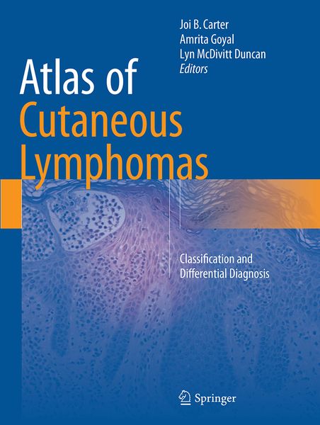 Produktbild: Atlas of Cutaneous Lymphomas