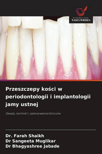 Produktbild: Przeszczepy ko&iquest;ci w periodontologii i implantologii jamy ustnej