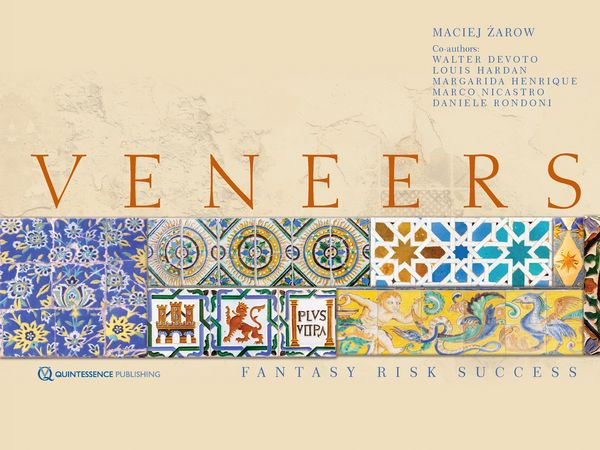 Produktbild: Veneers