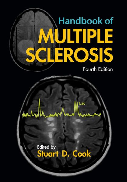 Produktbild: Handbook of Multiple Sclerosis
