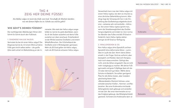 Produktbild: Hallux valgus