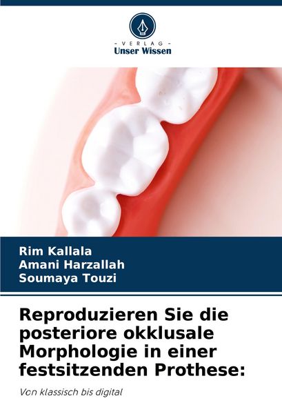 Produktbild: Reproduzieren Sie die posteriore okklusale Morphologie in einer festsitzenden Prothese: