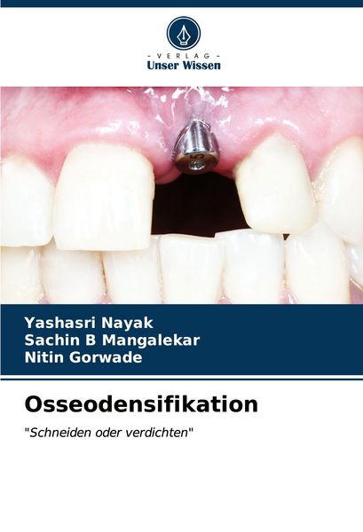 Produktbild: Osseodensifikation