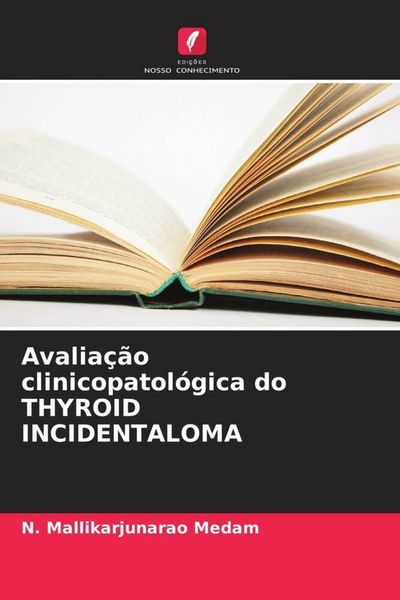 Produktbild: Avalia&ccedil;&atilde;o clinicopatol&oacute;gica do THYROID INCIDENTALOMA