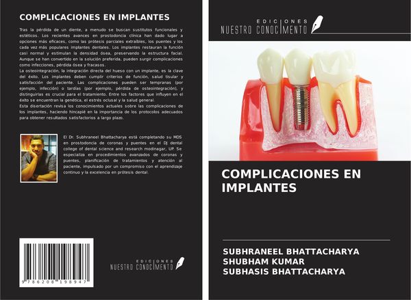 Produktbild: Complicaciones En Implantes