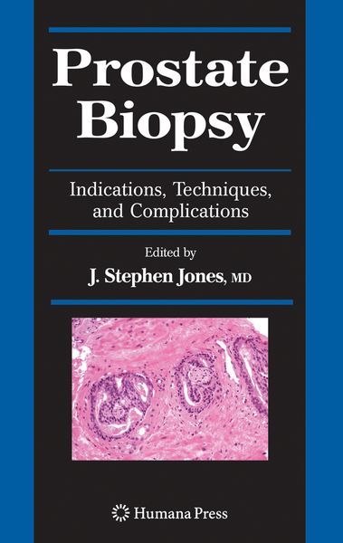 Produktbild: Prostate Biopsy