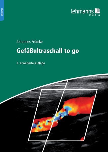 Produktbild: Gef&auml;&szlig;ultraschall to go
