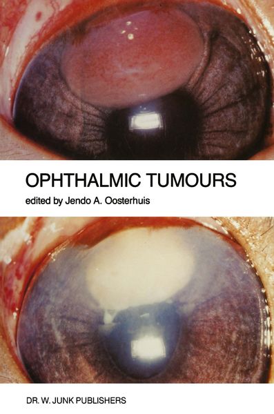 Produktbild: Ophthalmic Tumours