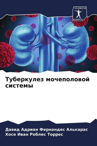 Produktbild: Tuberkulez mochepolowoj sistemy