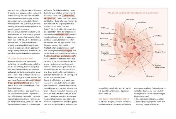 Produktbild: Endometriose &ndash; Was tun?