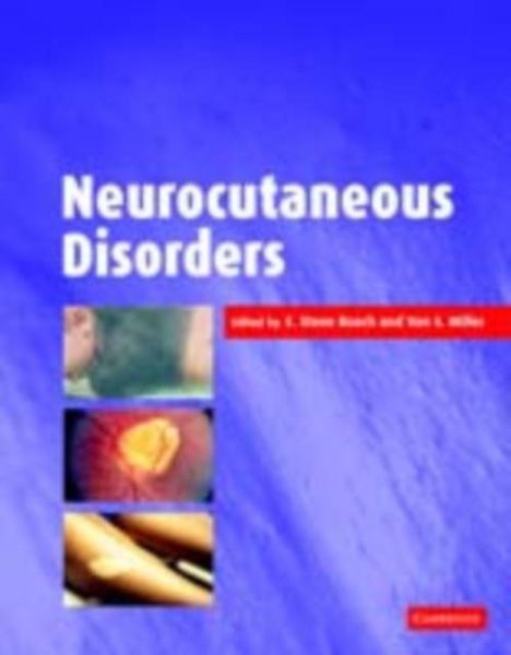 Produktbild: Neurocutaneous Disorders